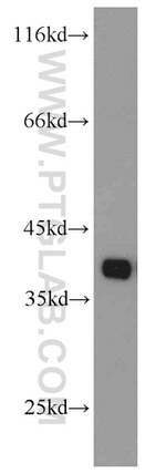 TMEM173/STING Antibody in Western Blot (WB)