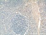 PCM1 Antibody in Immunohistochemistry (Paraffin) (IHC (P))