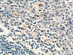 PCM1 Antibody in Immunohistochemistry (Paraffin) (IHC (P))