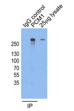 PCM1 Antibody in Immunoprecipitation (IP)