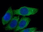 Spermidine synthase Antibody in Immunocytochemistry (ICC/IF)