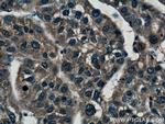 Spermidine synthase Antibody in Immunohistochemistry (Paraffin) (IHC (P))