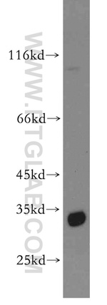 Spermidine synthase Antibody in Western Blot (WB)