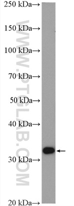 Spermidine synthase Antibody in Western Blot (WB)