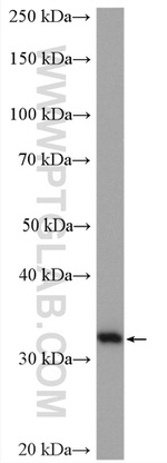 Spermidine synthase Antibody in Western Blot (WB)