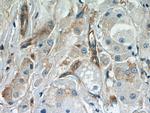 APPL1 Antibody in Immunohistochemistry (Paraffin) (IHC (P))