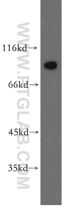 APPL1 Antibody in Western Blot (WB)