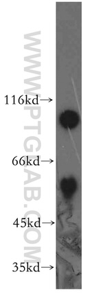 APPL1 Antibody in Western Blot (WB)