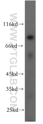 APPL1 Antibody in Western Blot (WB)