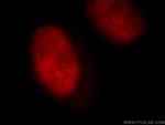 ILF3 Antibody in Immunocytochemistry (ICC/IF)