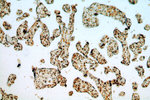 ILF3 Antibody in Immunohistochemistry (Paraffin) (IHC (P))