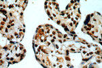 ILF3 Antibody in Immunohistochemistry (Paraffin) (IHC (P))