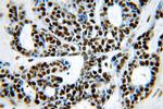 ILF3 Antibody in Immunohistochemistry (Paraffin) (IHC (P))