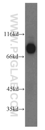 ILF3 Antibody in Western Blot (WB)