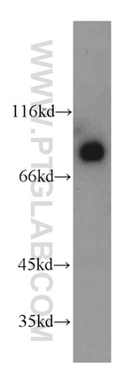 ILF3 Antibody in Western Blot (WB)