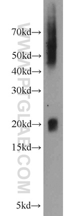 NPC2 Antibody in Western Blot (WB)