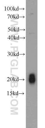 NPC2 Antibody in Western Blot (WB)