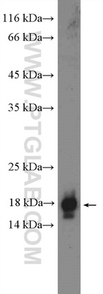 NPC2 Antibody in Western Blot (WB)