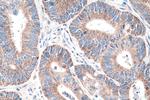 TRUB2 Antibody in Immunohistochemistry (Paraffin) (IHC (P))