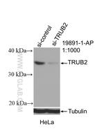 TRUB2 Antibody in Western Blot (WB)