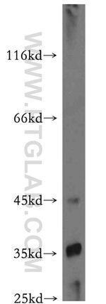 TRUB2 Antibody in Western Blot (WB)