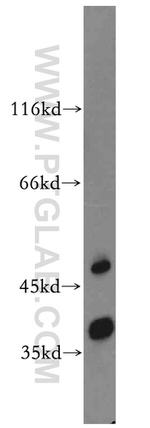 TRUB2 Antibody in Western Blot (WB)