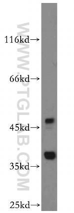 TRUB2 Antibody in Western Blot (WB)