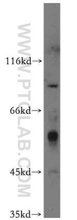 RFWD3 Antibody in Western Blot (WB)