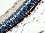 IMPG1 Antibody in Immunohistochemistry (Paraffin) (IHC (P))