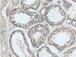 C11orf79 Antibody in Immunohistochemistry (Paraffin) (IHC (P))