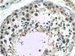 C11orf79 Antibody in Immunohistochemistry (Paraffin) (IHC (P))