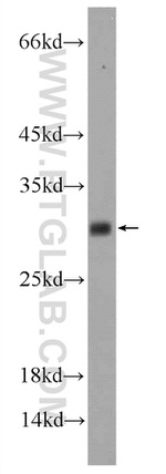 C11orf79 Antibody in Western Blot (WB)