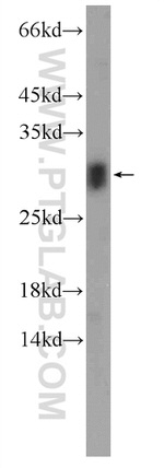 C11orf79 Antibody in Western Blot (WB)