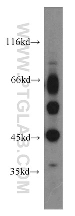 SLC10A3 Antibody in Western Blot (WB)