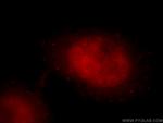 DDX17 Antibody in Immunocytochemistry (ICC/IF)