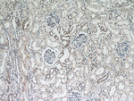 DDX17 Antibody in Immunohistochemistry (Paraffin) (IHC (P))