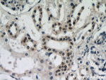 DDX17 Antibody in Immunohistochemistry (Paraffin) (IHC (P))