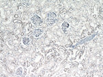 DDX17 Antibody in Immunohistochemistry (Paraffin) (IHC (P))