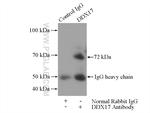 DDX17 Antibody in Immunoprecipitation (IP)