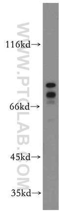 DDX17 Antibody in Western Blot (WB)