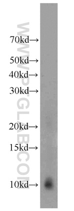 C20orf149 Antibody in Western Blot (WB)