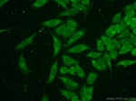 TMEM38B Antibody in Immunocytochemistry (ICC/IF)