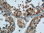 TMEM38B Antibody in Immunohistochemistry (Paraffin) (IHC (P))