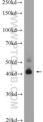 TMEM38B Antibody in Western Blot (WB)