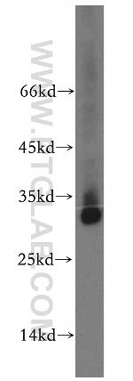 TMEM38A Antibody in Western Blot (WB)