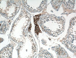 ZSCAN5A Antibody in Immunohistochemistry (Paraffin) (IHC (P))