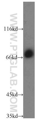 CEP72 Antibody in Western Blot (WB)