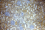 HEY1 Antibody in Immunohistochemistry (Paraffin) (IHC (P))