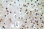 HEY1 Antibody in Immunohistochemistry (Paraffin) (IHC (P))