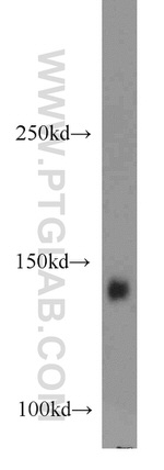 ERBB4 Antibody in Western Blot (WB)